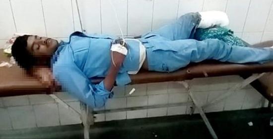 印度医院涉嫌用伤员断腿当枕头 几名涉事者被停职处理