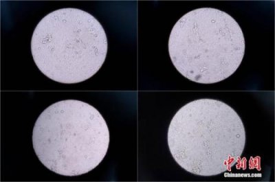 西班牙流感肆虐致900人死亡 医生提醒注意卫生最好多洗手